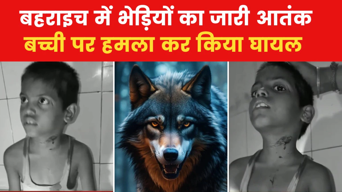 Bahraich Wolf attack on child